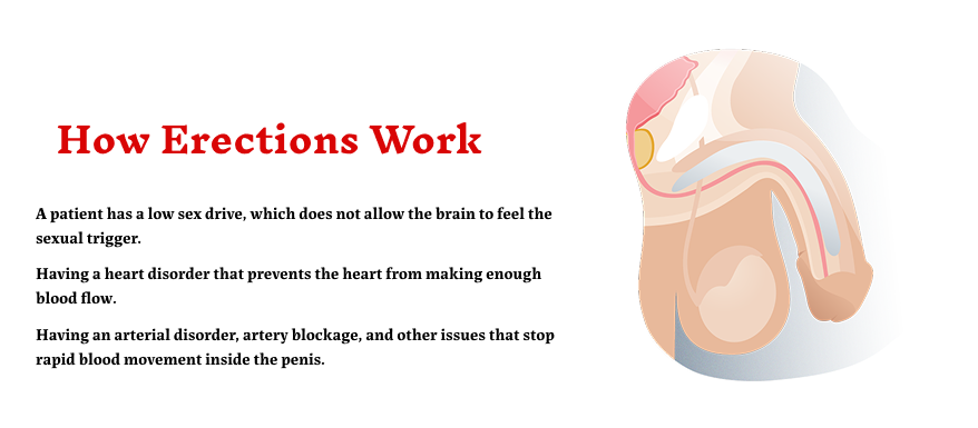 How Erections Work 